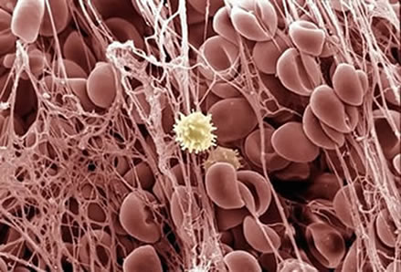 грибной мицелий в крови